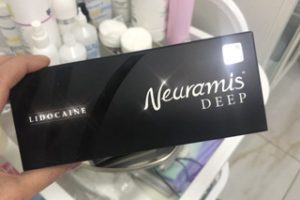 Neuramis Deep with Lidocaine photo review