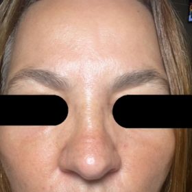 Curenex Rejuvenating Solution photo review