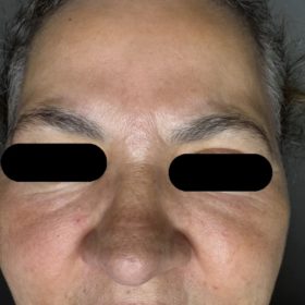 Curenex Rejuvenating Solution photo review