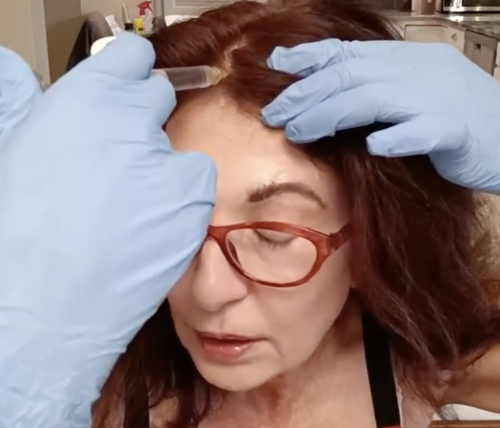 HAIRNA Exosome Hair Fill photo review