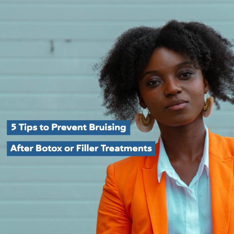 5 Tips to Prevent Bruising After Botox or Filler