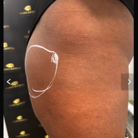 Venufill Body Filler Hard Type photo review