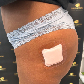 Venufill Body Filler Hard Type photo review