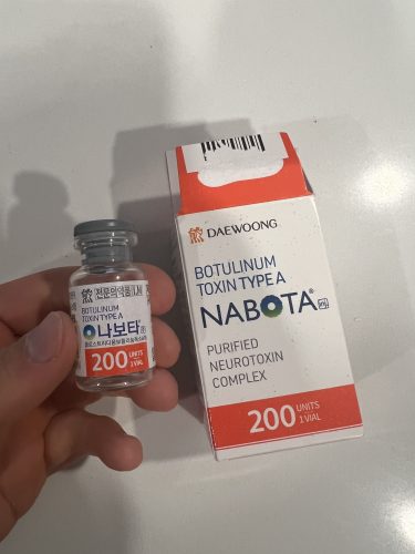 Nabota 200 Units photo review