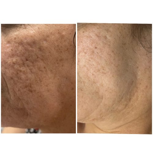 SkinCulture DN64 0.25mm 1pc photo review