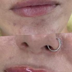 Yvoire Volume Plus photo review
