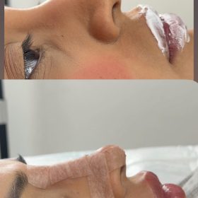 Yvoire Volume Plus photo review