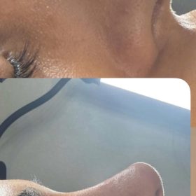 Yvoire Volume Plus photo review