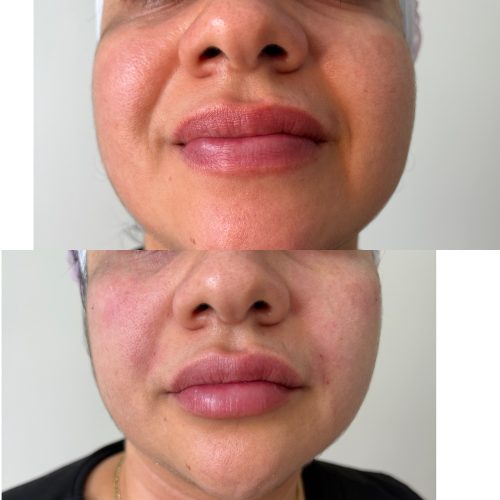Yvoire Volume Plus photo review